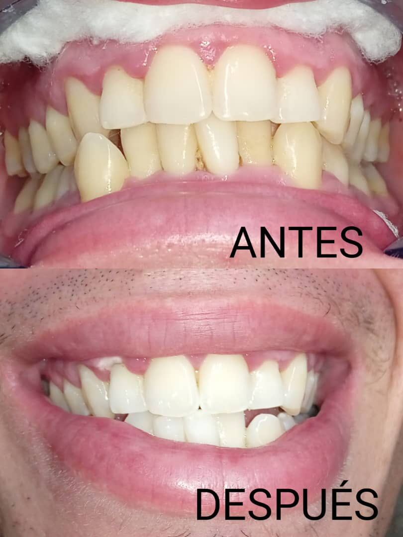 Trabajo 3