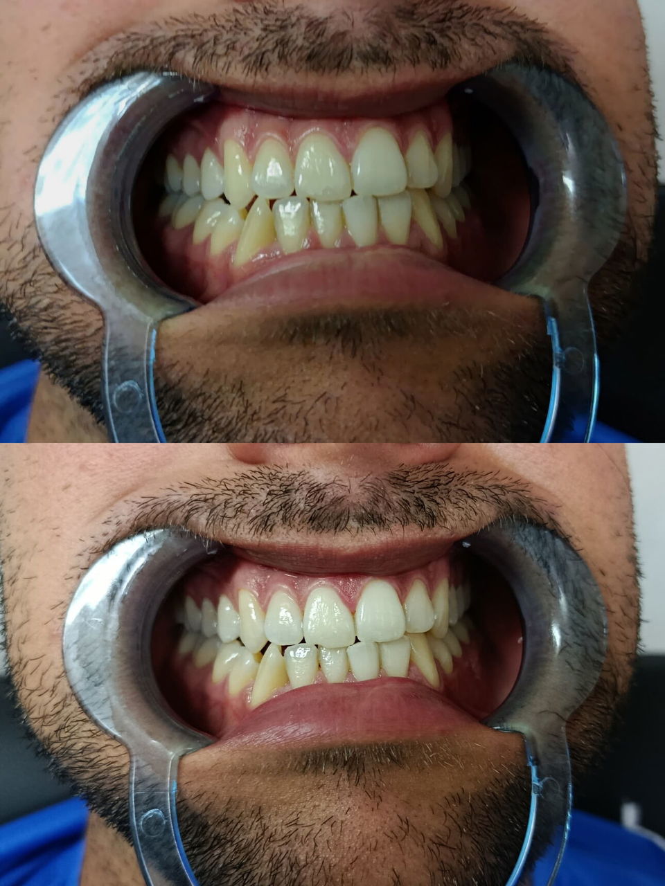 Trabajo 3