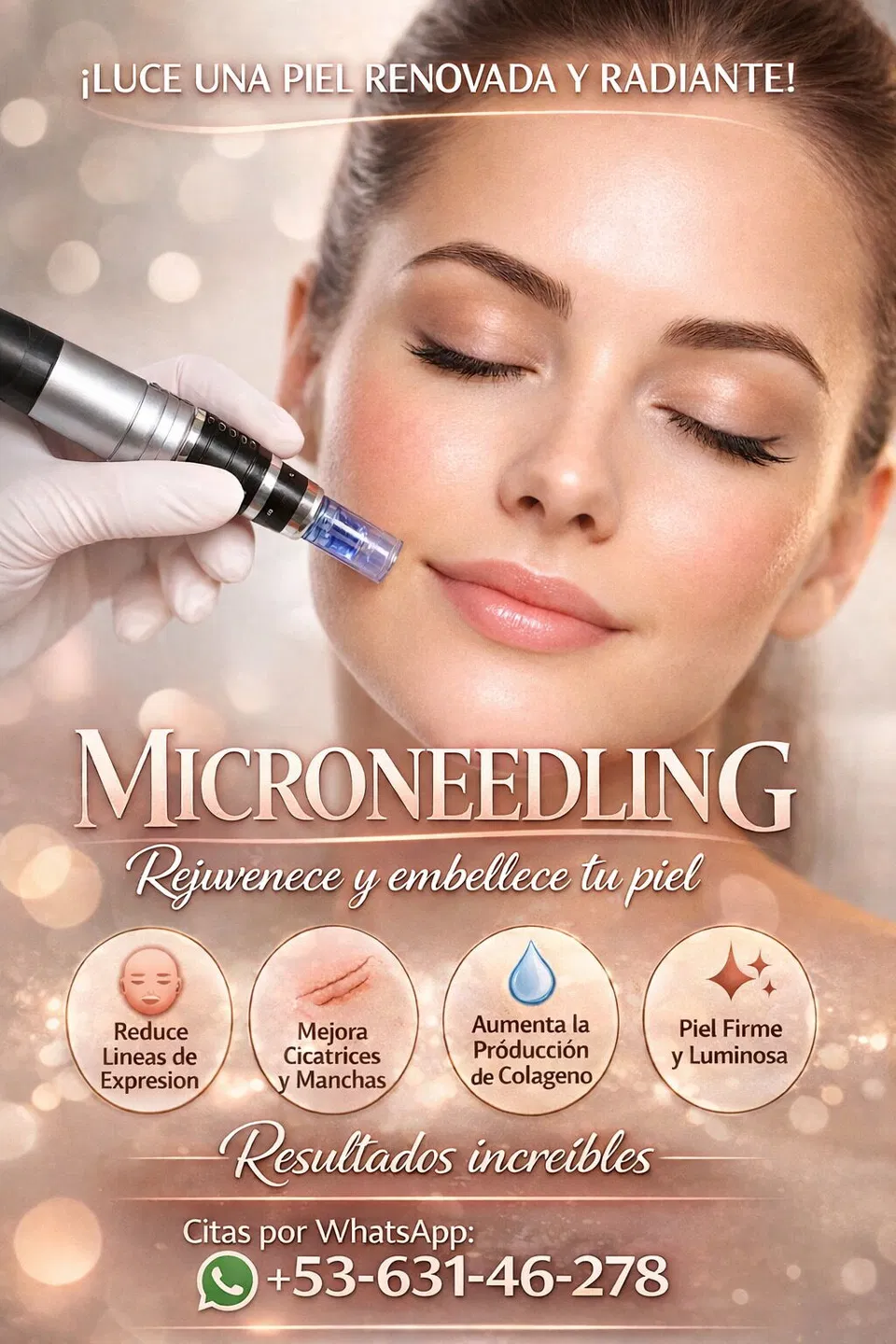 Portada de Tratamientos faciales y corporales: Microneedling para renovar tu piel