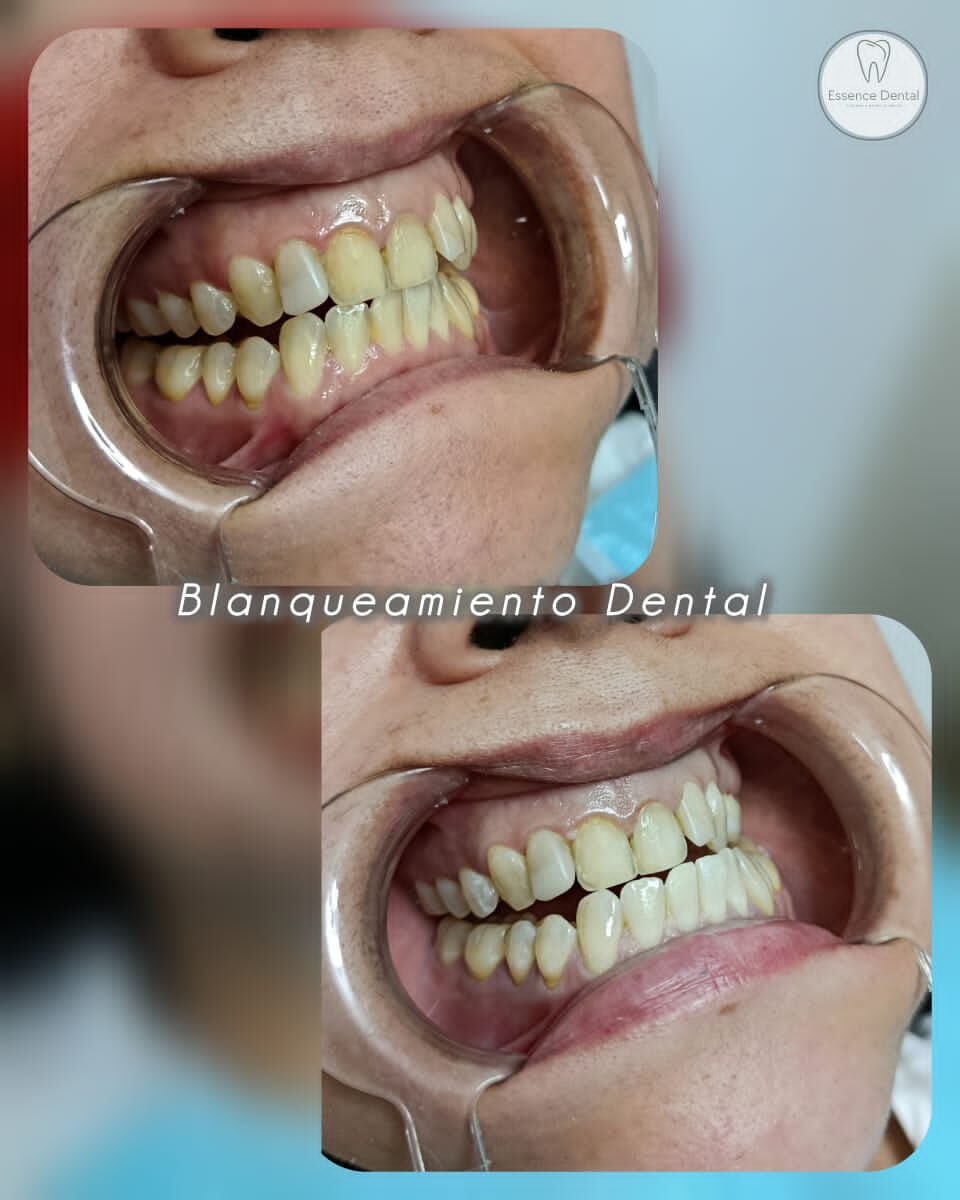 Trabajo 2