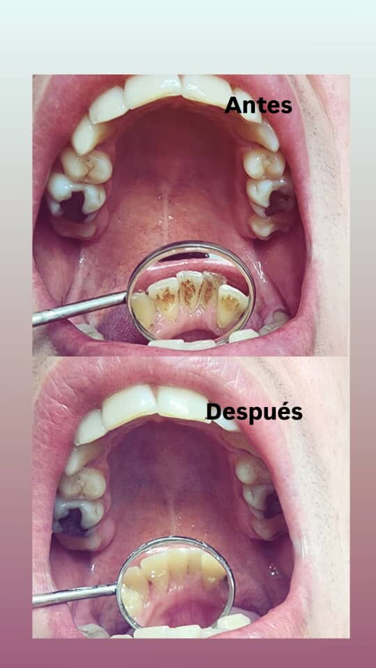 Trabajo 5