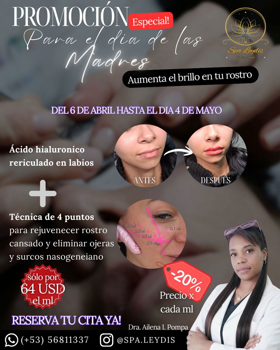 Trabajo 3