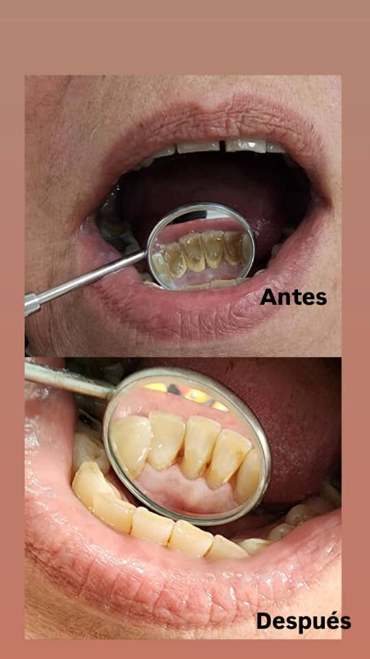 Trabajo 4