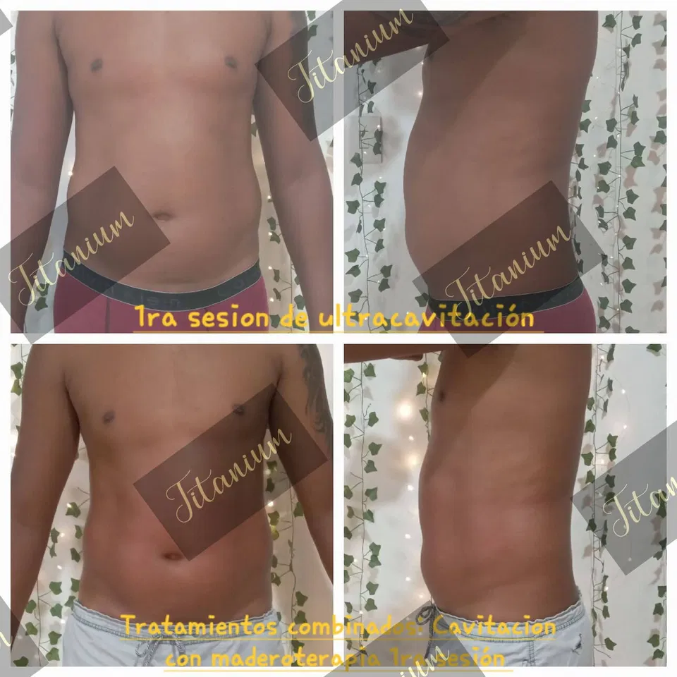 Trabajo 4