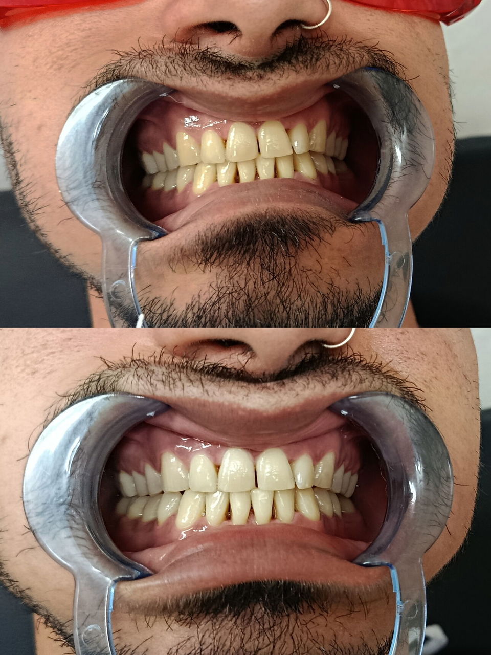Trabajo 5
