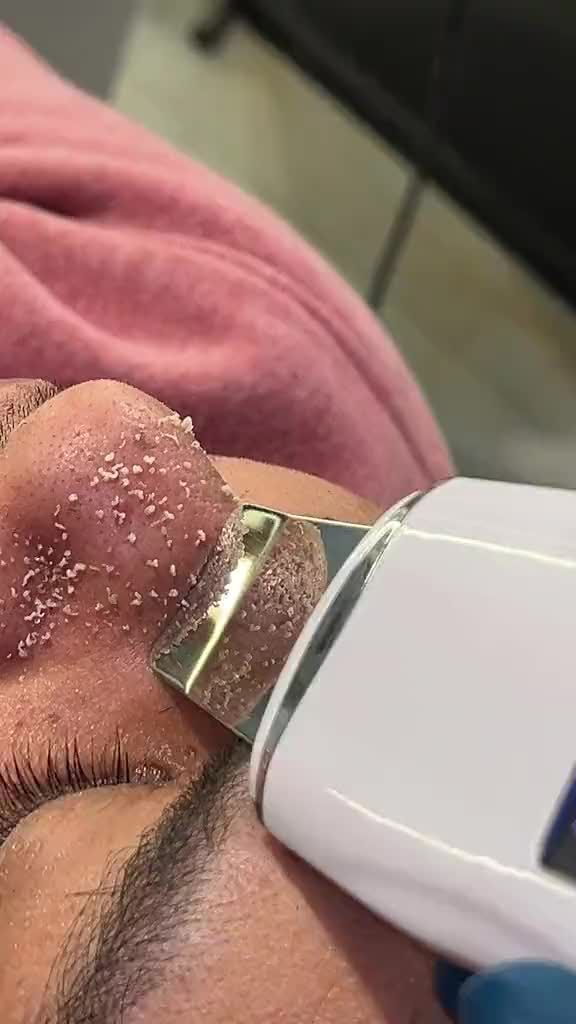 Portada de Limpieza Facial Profunda a Domicilio en La Habana