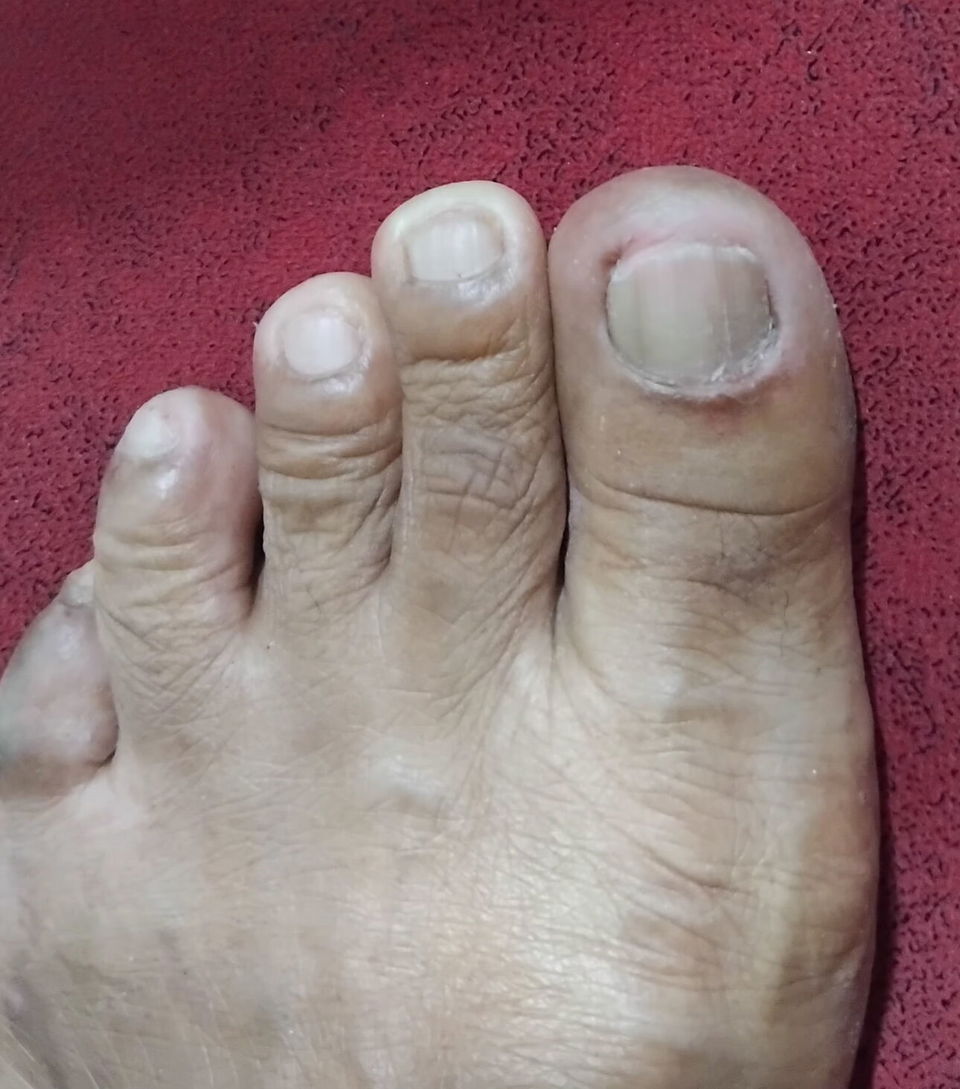 Portada de Pedicura a domicilio para personas mayores en El Cerro
