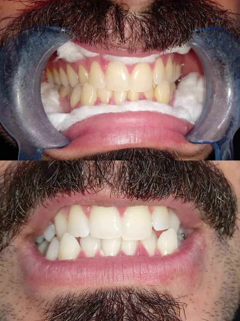 Trabajo 4