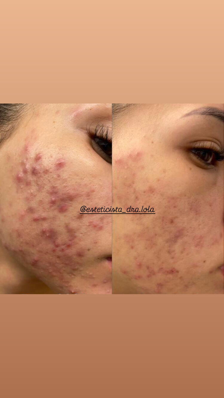 Portada de Shae’s Aesthetic Center: Cosmetología y Cosmiatría profesional. Faciales y corporales.