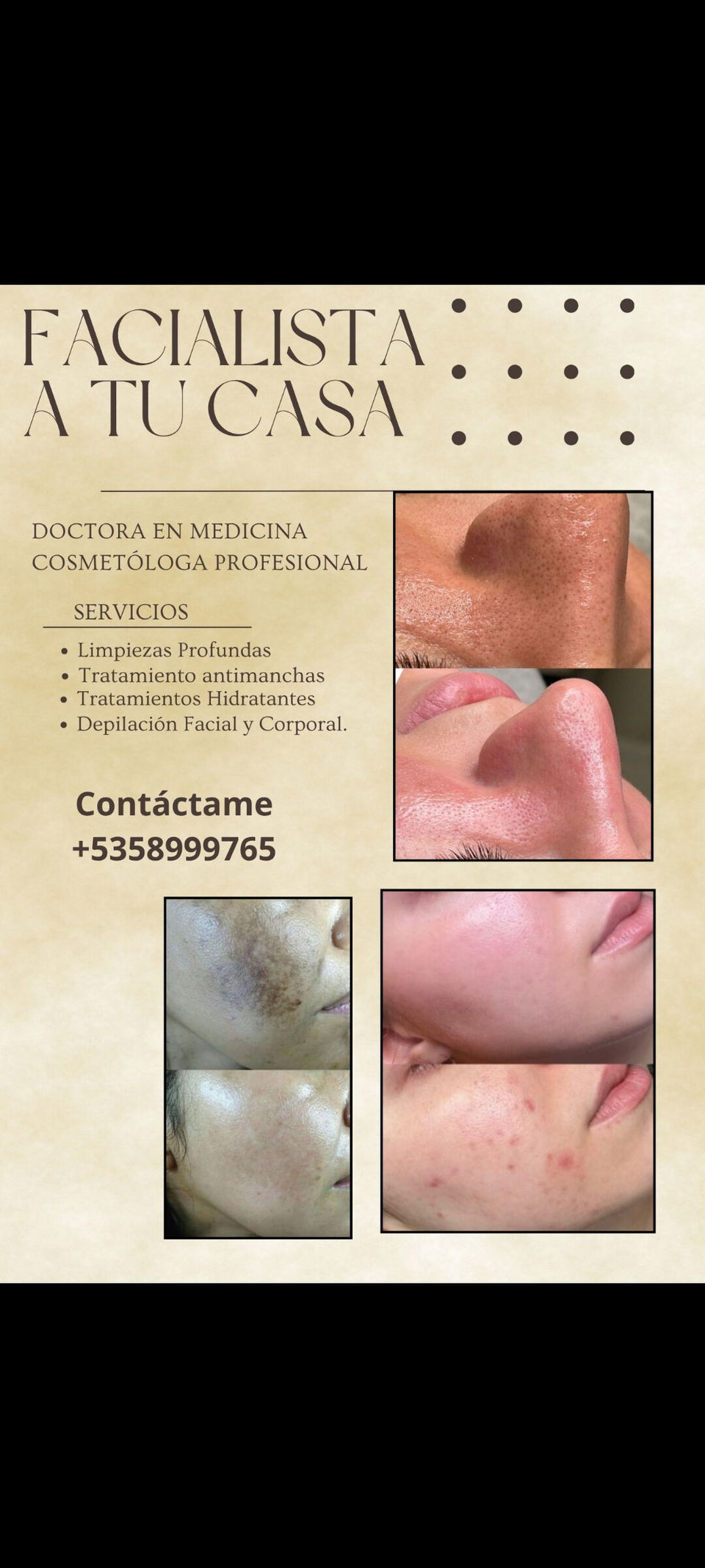 Portada de Esteticista de confianza: limpieza facial y depilación en La Habana
