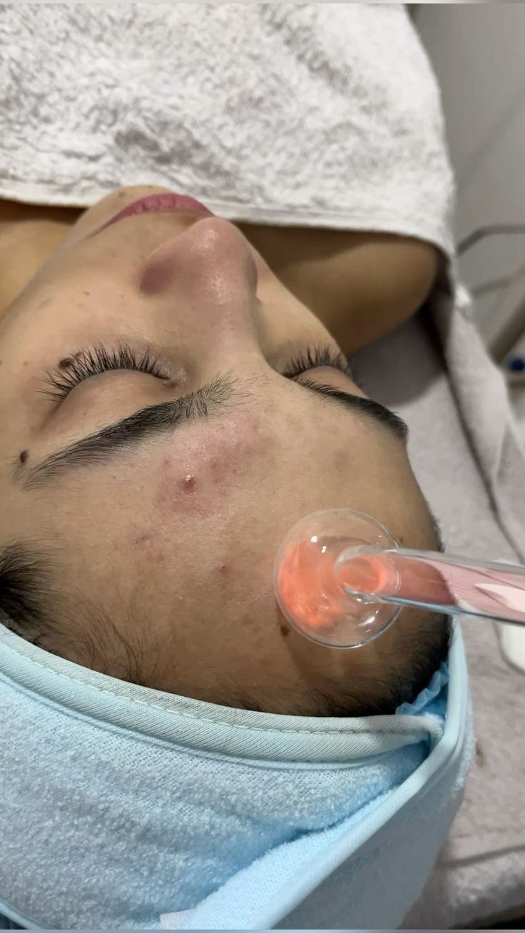 Portada de Limpieza facial con aparatología básica y tratamientos especializados