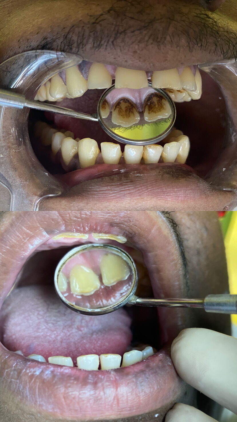 Trabajo 4