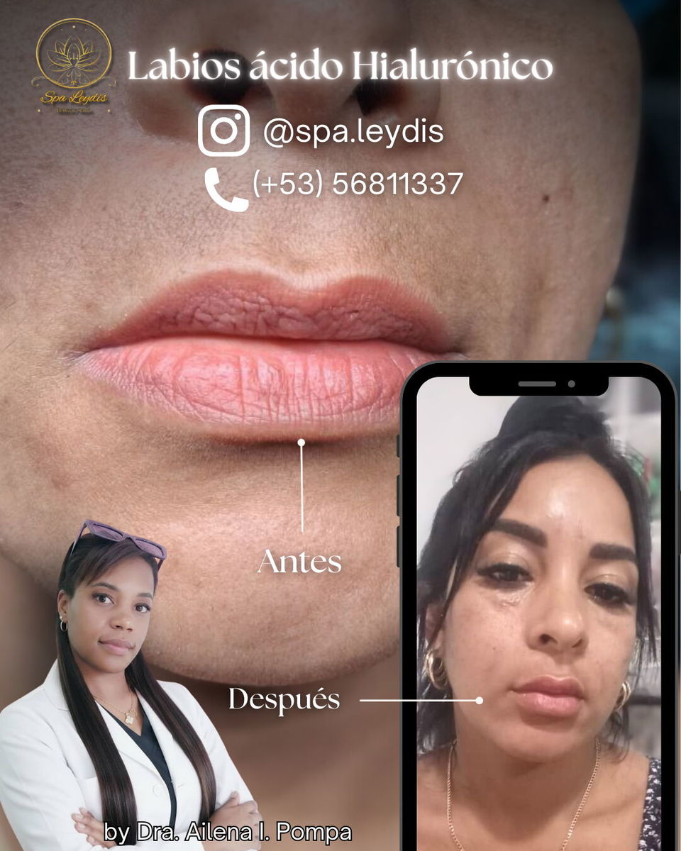 Trabajo 4