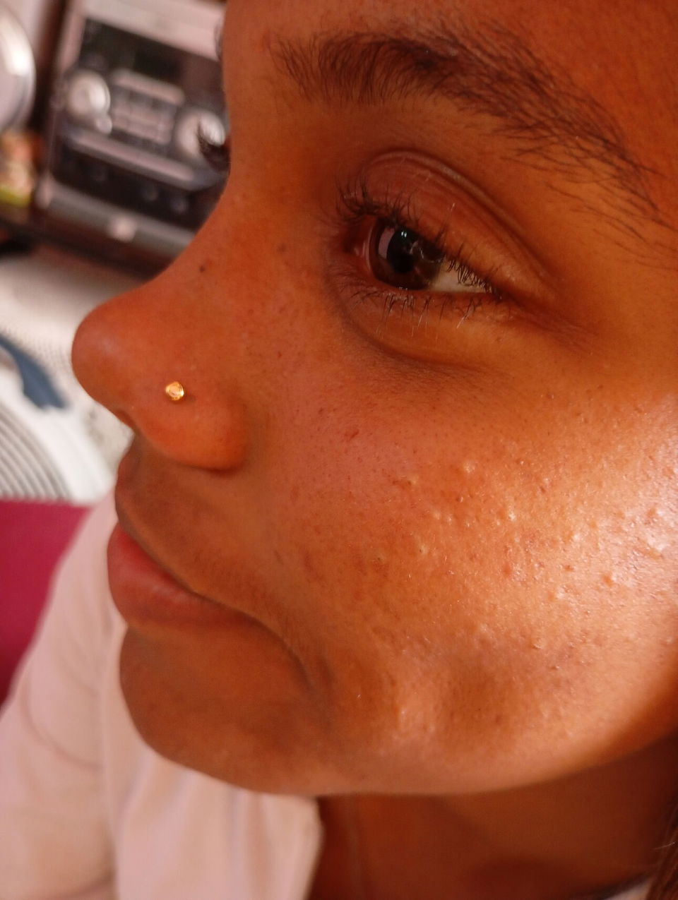 Portada de Perforaciones de orejas para bebés y adultos con aretes antialérgicos medicinales
