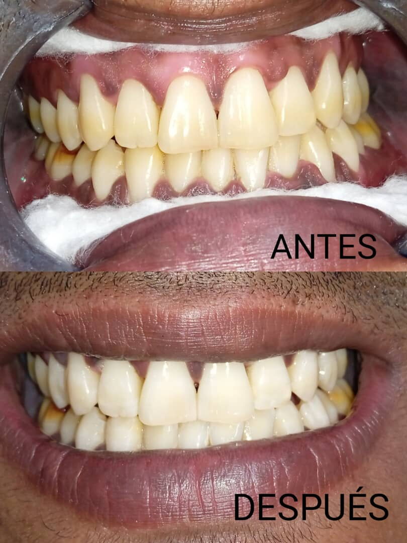 Trabajo 2